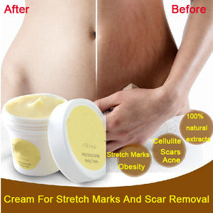 Thailand pasjel precious Skin Body Cream  stretch marks remover scar removal powerful postpartum obesity pregnancy cream